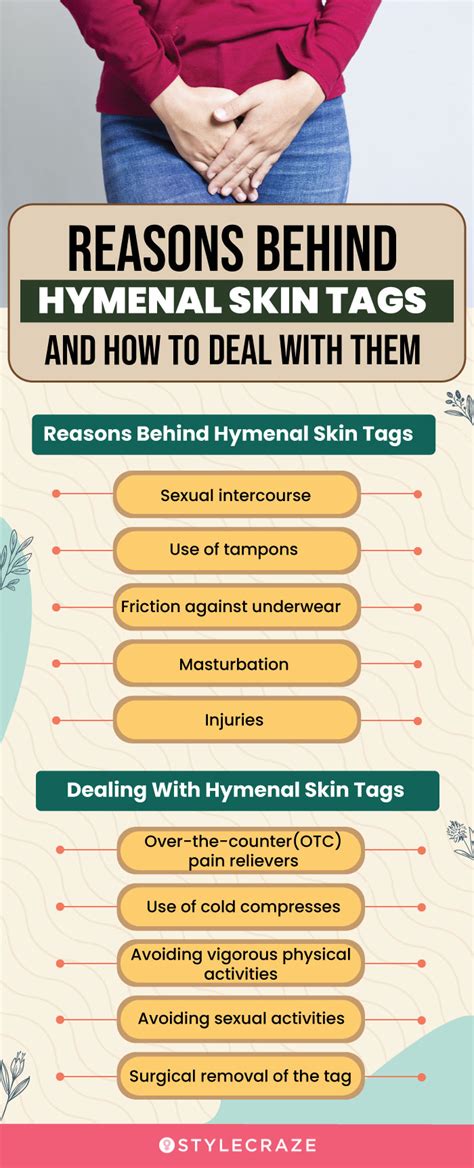 A hymenotomy is a minor surgical procedure to remove extra tissue from the hymen. . Hymenal skin tags after giving birth